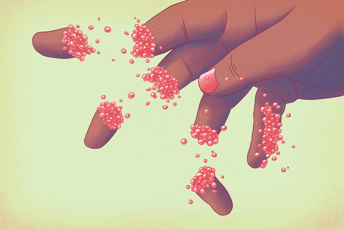 Art print of literal finger limes